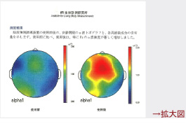 脳内のリラクゼーション変化